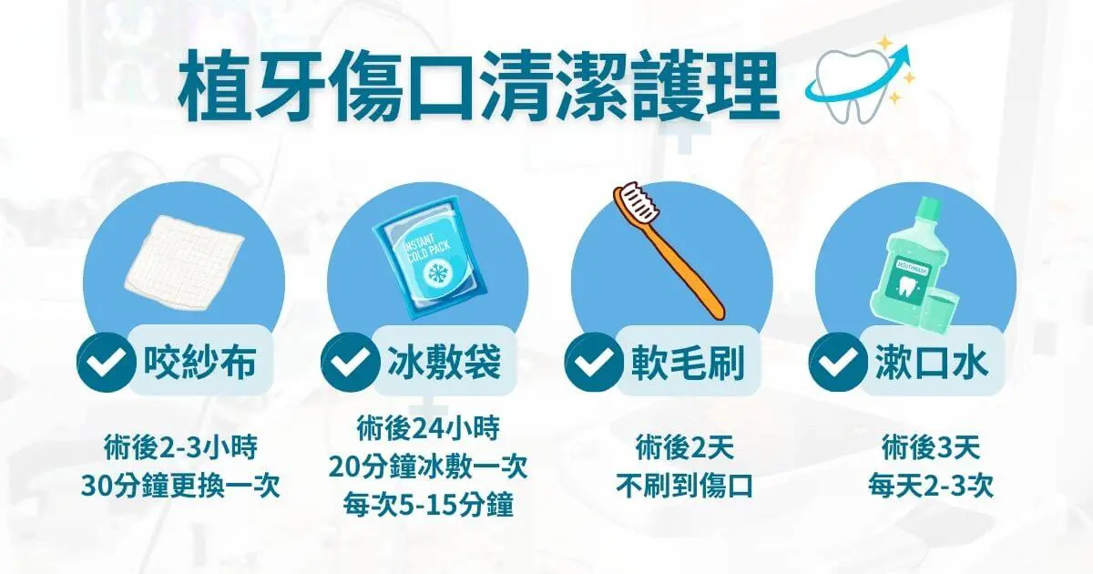 植牙後注意事項有哪些?術後清潔、飲食、保養一次看 1 植牙後注意事項:植牙傷口清潔護理