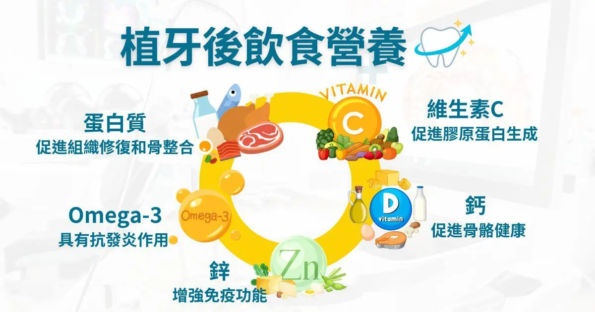 植牙後注意事項有哪些?術後清潔、飲食、保養一次看 3 植牙後飲食營養重點整理