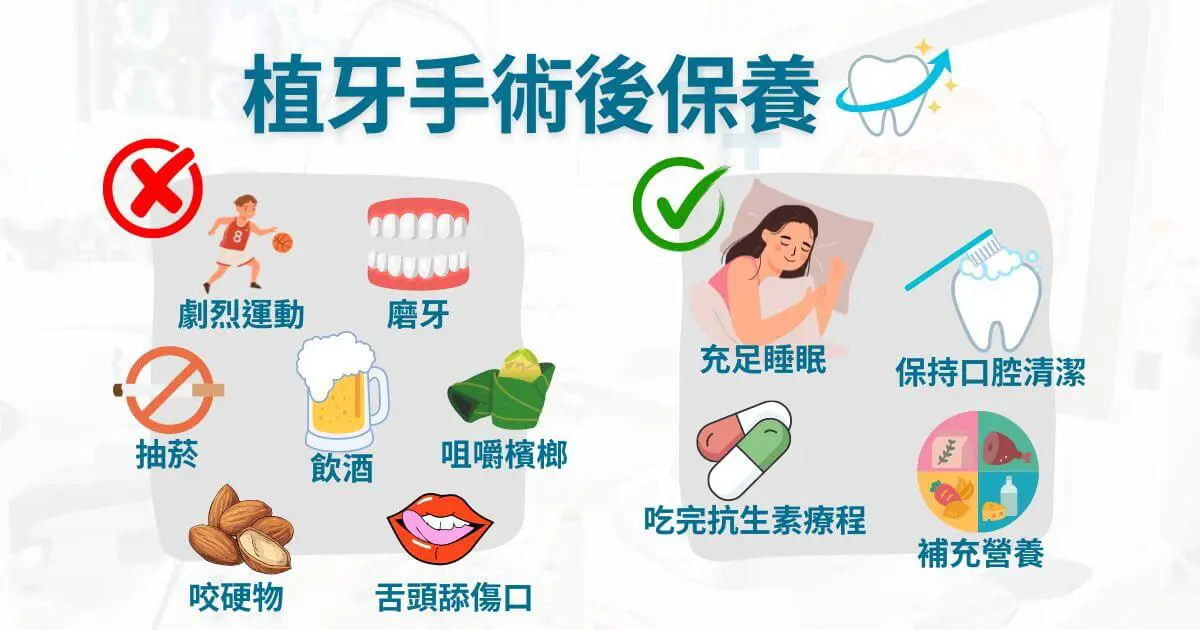 植牙後注意事項有哪些?術後清潔、飲食、保養一次看 2 植牙手術後保養:什麼能做與什麼不能做?