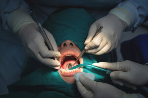 案例分享 3 perio img2